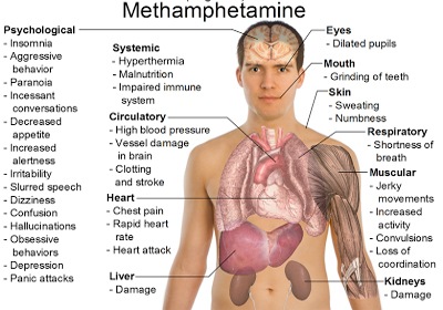 Methamphetamine Addiction & effects on the body