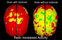 Adderall Detox and Withdrawal